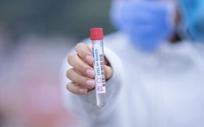 Coronavirus: contagi in continua crescita, +151